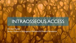 Intraosseous access [upl. by Secundas369]