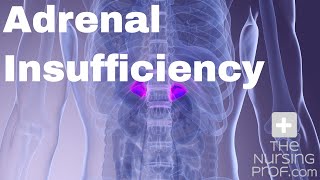 Adrenal Insufficiency [upl. by Gnilsia]