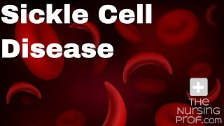 Sickle Cell Disease and Sickle Cell Crisis [upl. by Landsman]