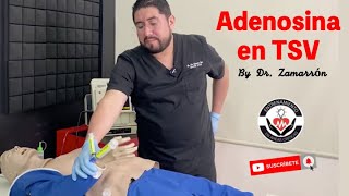 TAQUICARDIA SUPRAVENTRICULAR  ¿Cómo administrar la ADENOSINA [upl. by Coady771]