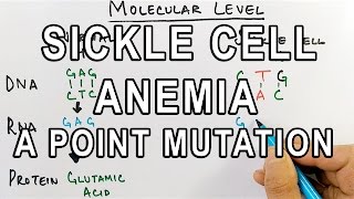 Sickle Cell Anemia  A Detailed Genetics [upl. by Eleen670]