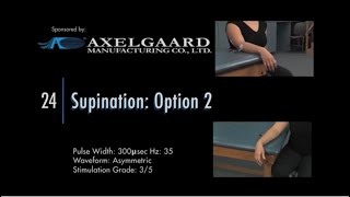 Electrode Placement for Supination Option 2 [upl. by Barcellona658]