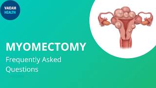 Myomectomy Frequently Asked Questions [upl. by Cartie]