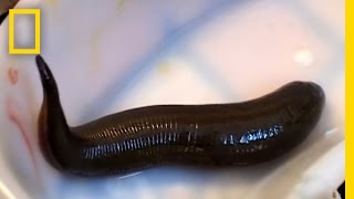 Leeches Cure  National Geographic [upl. by Countess]