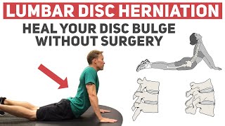 How to Heal Your Disc Herniation Without Surgery [upl. by Hildegard]