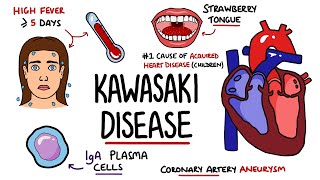 Understanding Cardiovascular Disease Visual Explanation for Students [upl. by Arymahs]