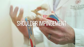 Shoulder Impingement Causes and Treatment [upl. by Posehn]