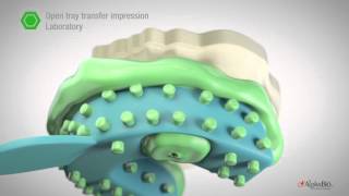 How to take open close tray impression  AlphaBio Tec [upl. by Devine]