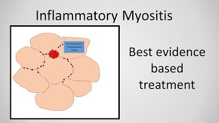 Myositis Patient Experience [upl. by Ellenaej]