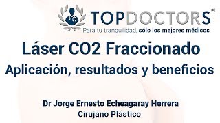 Usos y beneficios del Laser CO2 Fraccionado  Clínica UNIDERMA Perú [upl. by Willi]