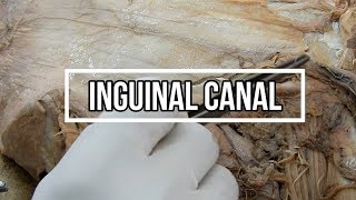 Inguinal Canal [upl. by Ramal]