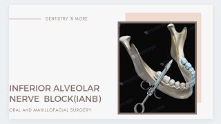 INFERIOR ALVEOLAR NERVE BLOCK [upl. by Allerym]