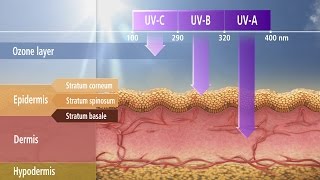 NonMelanoma Skin Cancer [upl. by Fae]