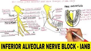 Inferior Alveolar Nerve Block  IANB [upl. by Assillim]