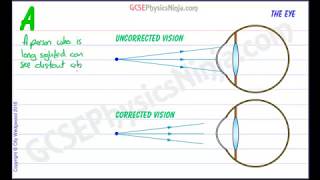 Long Sighted Vision Correction  Physics of Light [upl. by Witt115]