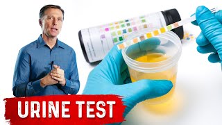 Urine Test Simplified [upl. by Odlabu672]