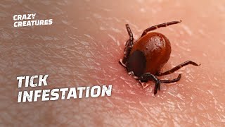 WARNING The Most Horrific Tick Infestations [upl. by Jeannine]