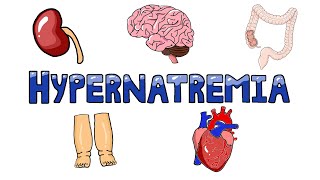 An Approach to Hypernatremia  Hypernatremia Diagnostic Algorithm  Hypernatremia Causes MADE EASY [upl. by Attolrac]