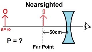 Physics  Optics Vision Correction 2 of 5 Nearsighted [upl. by Corneille]