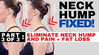 How to Get Rid of Neck Pain From Sleeping Wrong [upl. by Nairrot]