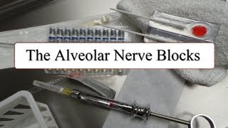 The Alveolar Nerve Blocks [upl. by Lawrence683]