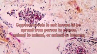 Cryptococcus Fungi The Cause of Cryptococcosis [upl. by Epifano]