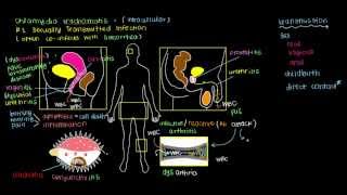 Rheumatoid Arthritis RA Signs amp Symptoms amp Associated Complications [upl. by Albric]