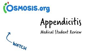 Appendicitis  Clinical Presentation [upl. by Llibyc]