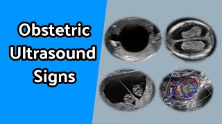 Obstetric Ultrasound Signs [upl. by Scopp]