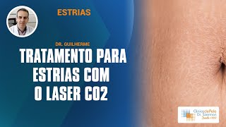 Estrias Aplicação do Laser Co2 Fracionado [upl. by Eerol]