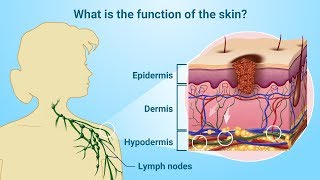 Understanding Melanoma [upl. by Nanaj]