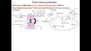 Toxic shock syndrome [upl. by Kreit330]