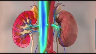 Myositis Inflammatory Myopathy Treatment [upl. by Kelwen491]