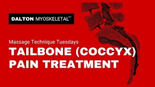 Tailbone Pain Treatment using Myoskeletal Alignment Techniques [upl. by Maleeny]