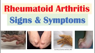 Urethritis Definition amp Pathology – Infectious Diseases  Lecturio [upl. by Ettenaj]