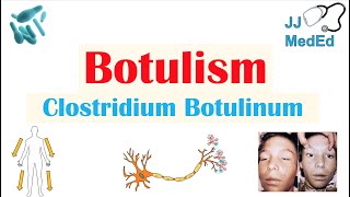 Botulism Clostridium Botulinum Pathogenesis Symptoms Diagnosis Treatment Prevention [upl. by Steward]