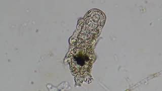 This is a Tardigrade [upl. by Hesper]