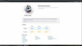 3D Slicer Tutorial 1 Basics [upl. by Etteuqaj]