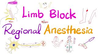 Limb Block  Peripheral Nerve Block  Regional anesthesia [upl. by Calondra]