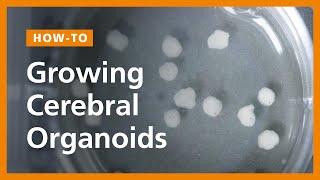 How to Grow Cerebral Organoids from Human Pluripotent Stem Cells [upl. by Tnomed]