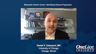 Breast Cancer Metastasis When Can It Happen [upl. by Cowen]