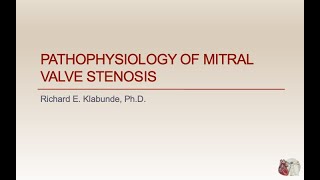 Understanding Mitral Stenosis Signs and Symptoms [upl. by Chiang287]