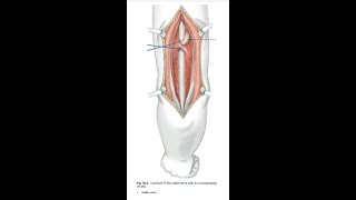 Posterior Approach to Humerus [upl. by Notyalc746]