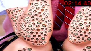 Do YOU Have Trypophobia [upl. by Northington]