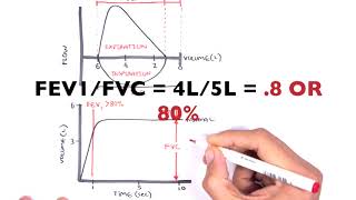 Understanding Spirometry  Normal Obstructive vs Restrictive [upl. by Yniatirb]