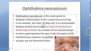 Ophthalmology Neonatal Conjunctivitis Ophthalmia Neonatorum Causes Eye Discharge in Baby Newborn [upl. by Arries]