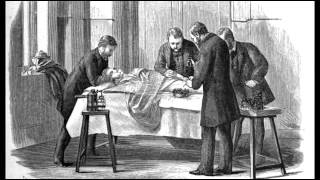 12th August 1865 Joseph Lister carries out worlds first antiseptic surgery [upl. by Rubina]