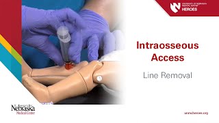 Intraosseous Access  Line Removal [upl. by Holihs166]