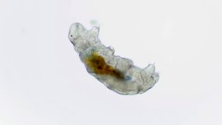 Tested From Home How to Find Tardigrades In Your Backyard [upl. by Linskey178]