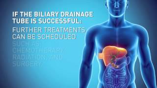 Biliary Drain [upl. by Gnilrets301]